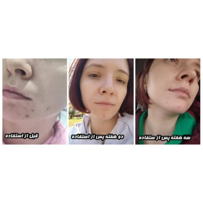 Beauty of Joseon Light On Serum Centella + Vita C 30ml